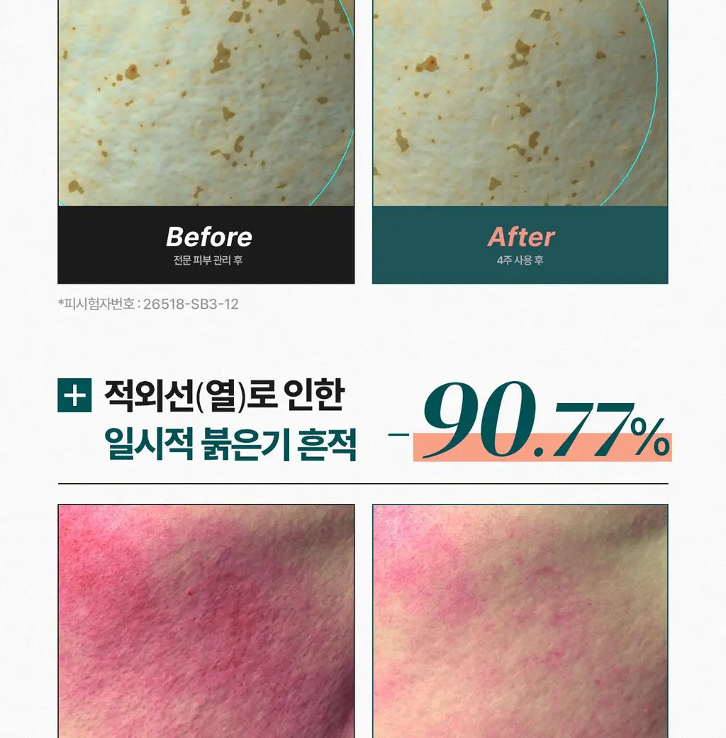 [흔적 리페어_c-PDRN 10,000 PPM]리쥬덱스 더마 리페어링 솔루션 앰플 10mLx2EA 상세페이지 9